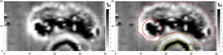 Obraz wynikowy pomiarów magnetometrycznych “podwójnego kurhanu”, składającego się z mogił nr 6 i 7 oraz kurhanu nr 18, należących do 1 grupy na cmentarzysku w Bukównej (gradientometr Bartington Fluxgate Grad 601-1; poligon pomiarowy: 10 × 10 m, gęstość próbkowania na rozstaw transektów: 0,25 × 1,0 m, interpolowana do 0,25 × 0,5 m; realne wartości pola magnetycznego skompresowane w skali szarości do zakresu -5 – +5nT) (po prawej). Obraz wynikowy pomiarów magnetometrycznych “podwójnego kurhanu”, składającego się z mogił nr 6 i 7, oraz kurhanu nr 18, przynależących do I grupy na cmentarzysku w Bukównej, z zaznaczonymi anomaliami opisywanymi w tekście (po lewej)